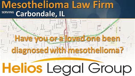 Litchfield, IL Lawyer with 9 years of experience. . Carbondale mesothelioma legal question